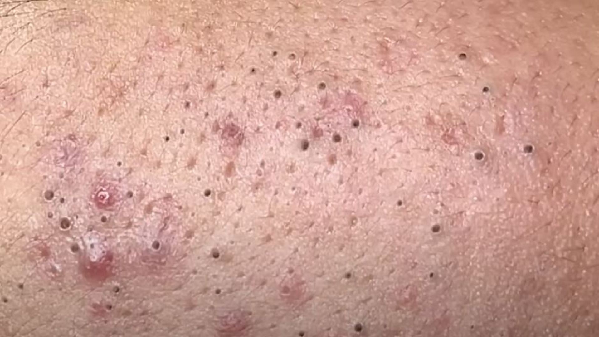 Fascinating Your Day with Hari Spa #855