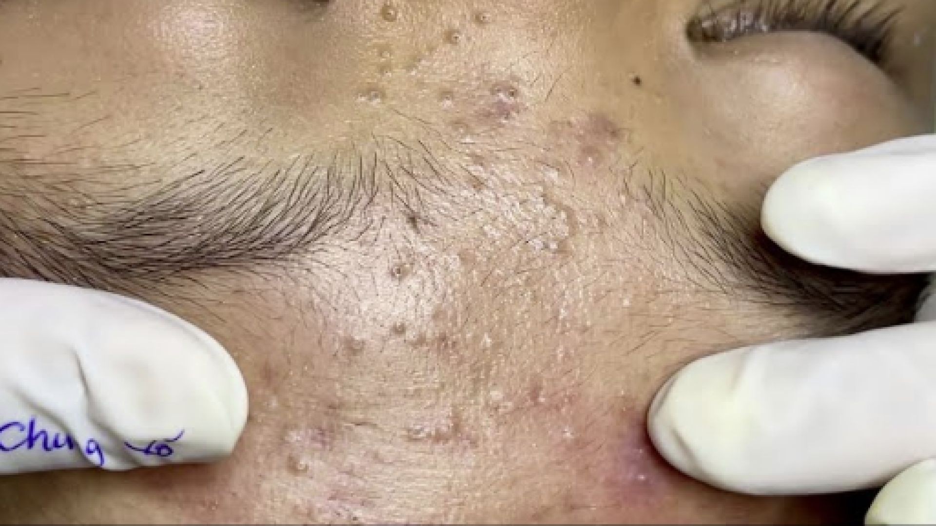 Satisfying video with Chung Vo Spa | 183