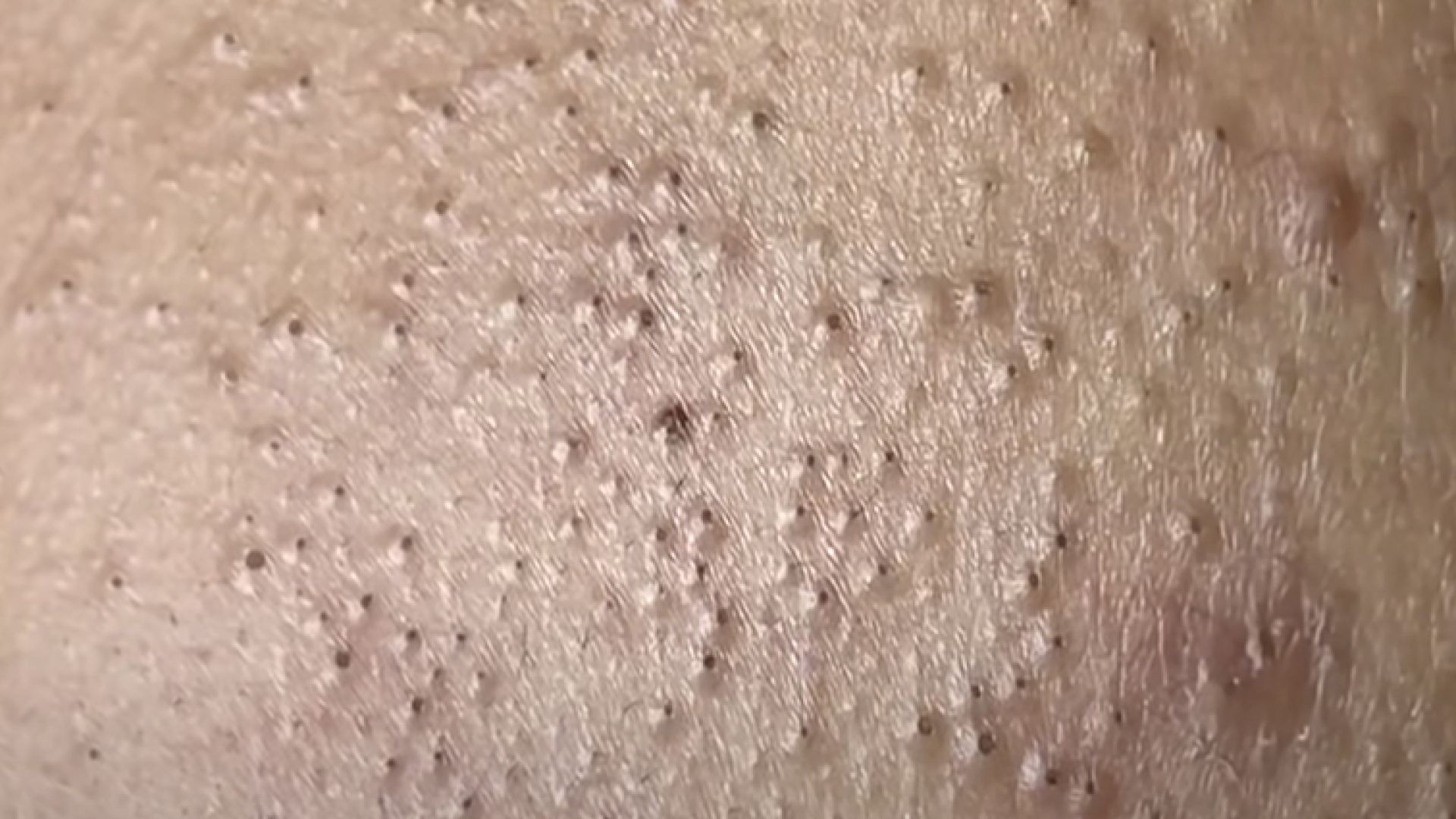 Satisfying video with Chung Vo Spa | 190